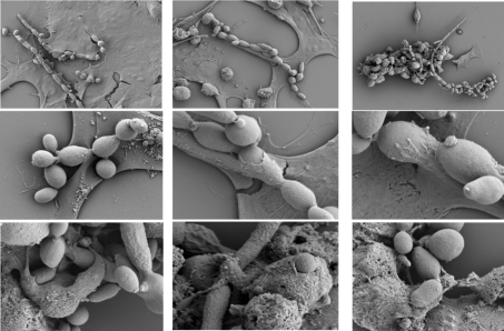 Slika6_SOOČENJE E. dermatitidis IN NEUROBLASTOV (SEM)