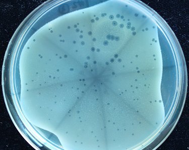 Decoration pics_phage plaques_Mercedes (6)
